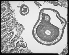 Dwarsdoorsnede volwassen rondworm in wormvormig aanhangsel