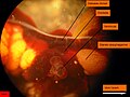 Arenicola marina. Vue du cœur droit. Le ventricule est contracté et presque vide. Les points jaunes sont des ovocytes.