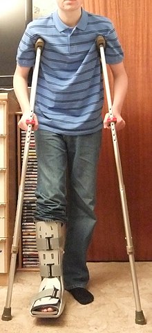 A boy using underarm (axillary) crutches to keep weight off the injured leg Axillary (underarm) crutches.JPG