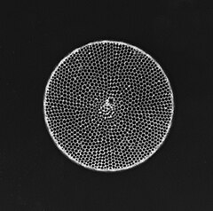 Diatomee - Diatom (fossile) - Thalassiosira sp. - 400x (14281808022).jpg