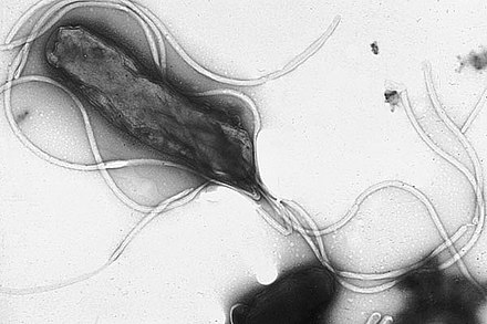 Helicobacter pylori electron micrograph, showing multiple flagella on the cell surface