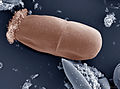 Entodinium (Ciliophora)