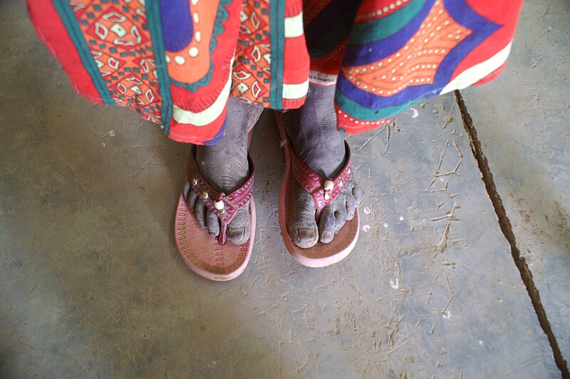 File:Feet from Burkina Faso 14.JPG