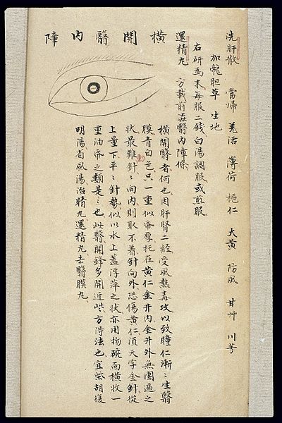 File:Illustration from Ming Chinese ophthalmology text, Ms copy Wellcome L0039700.jpg