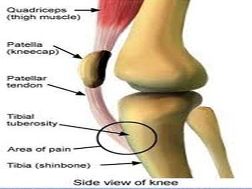 Why is the front of my knee in pain when bending it?