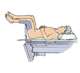 <span class="mw-page-title-main">Lithotomy position</span> Position for medical examinations and procedures