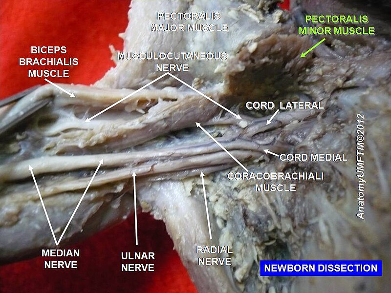 File:Slide4n.JPG