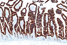 Micrograph showing CK20 immunostaining of normal small intestine. Small intestine - ck20 - intermed mag.jpg