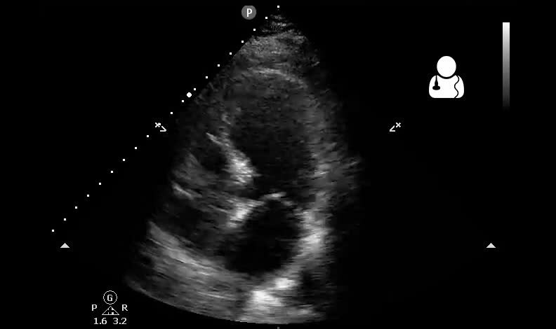 ملف:UOTW 36 - Ultrasound of the Week 1.webm