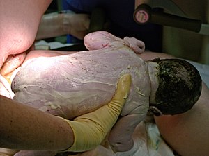 Bayi digendong dengan tangan bersarung tangan, dengan materi serupa krim di seluruh tubuh