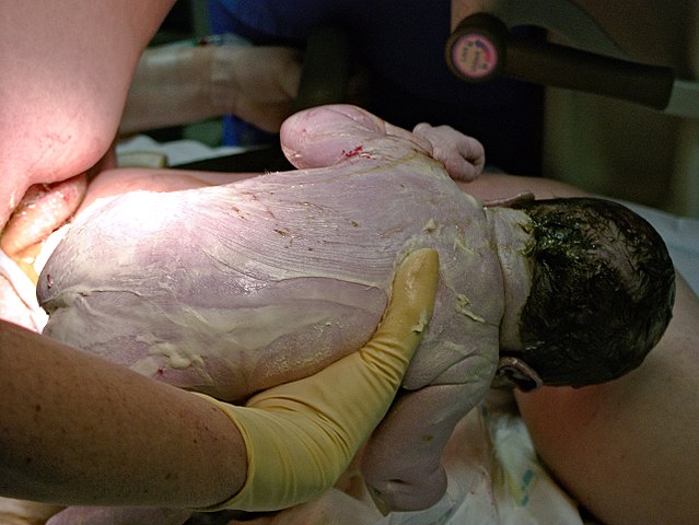 Vernix Caseosa: Wash It Off Baby After Birth or Rub It In?