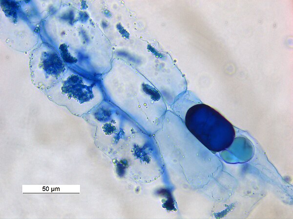 Arbuscles and hyphae in Vesicular Arbuscular Mycorhizae in root of Macrotyloma uniflorum . A vesicle is showing at right bottom