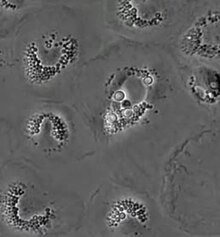 Datei: Vomozytose von Cryptococcus neoformans aus einem Vogelmakrophagen.webm