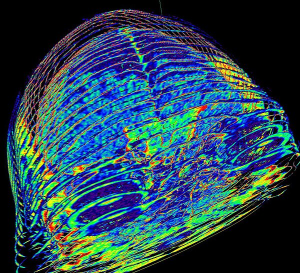 3D reconstruction of the brain and eyeballs from CT scanned DICOM images. In this image, areas with the density of bone or air were made transparent, 