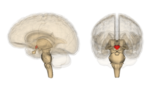 Wernicke encephalopathy presence of neurological symptoms caused by biochemical lesions of the central nervous system after exhaustion of B-vitamin reserves,