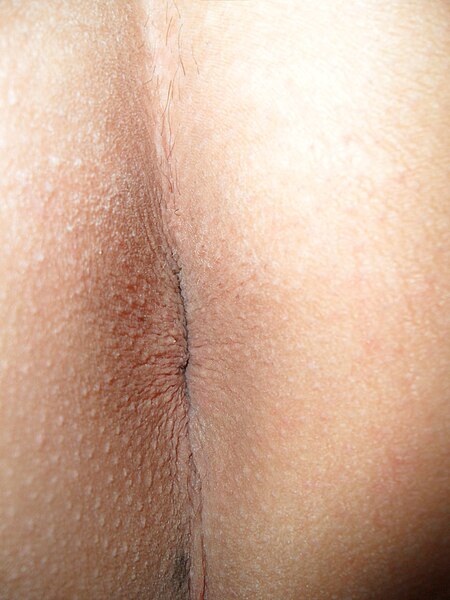 File:Male shaved anus.jpg