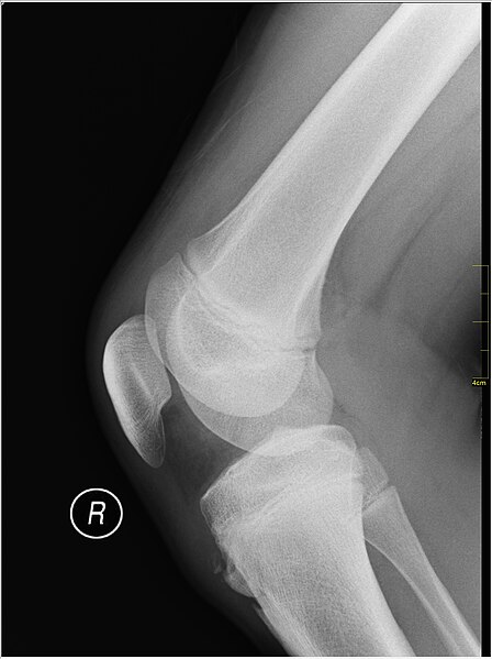 File:Medical X-Ray imaging JGG05 nevit.jpg