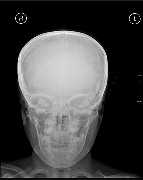 File:Medical X-Ray imaging SRY07 nevit.jpg