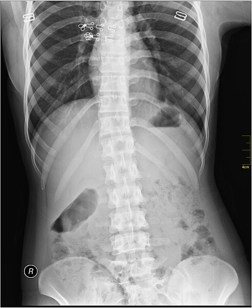 File:Medical X-Ray imaging TMA07 nevit.jpg