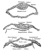 Section showing three stages in the formation of the amnion of bat embryo.jpg