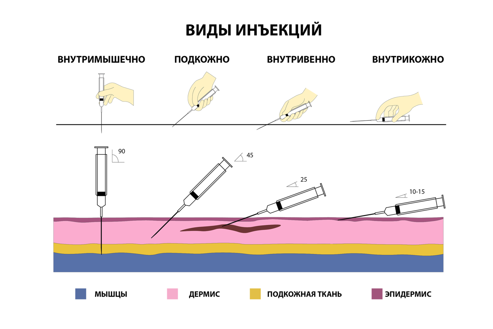 Угол наклона иглы при внутривенных инъекциях:. Подкожная инъекция угол введения иглы. Глубина введения иглы при проведении внутривенной инъекции. Угол наклона шприца при инъекциях.