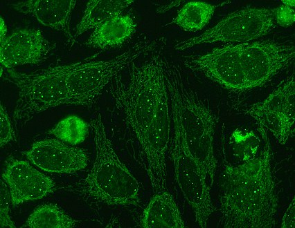 Immunofluorescence staining pattern of sp100 antibodies (nuclear dots) and antimitochondrial antibodies