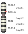 Cromozomul 20.svg