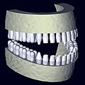 Rekonstruiertes 3D-Zahnmodel aus Daten eines DVT-Scans
