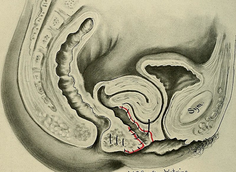 File:Gynecology (1916) (14799799973).jpg