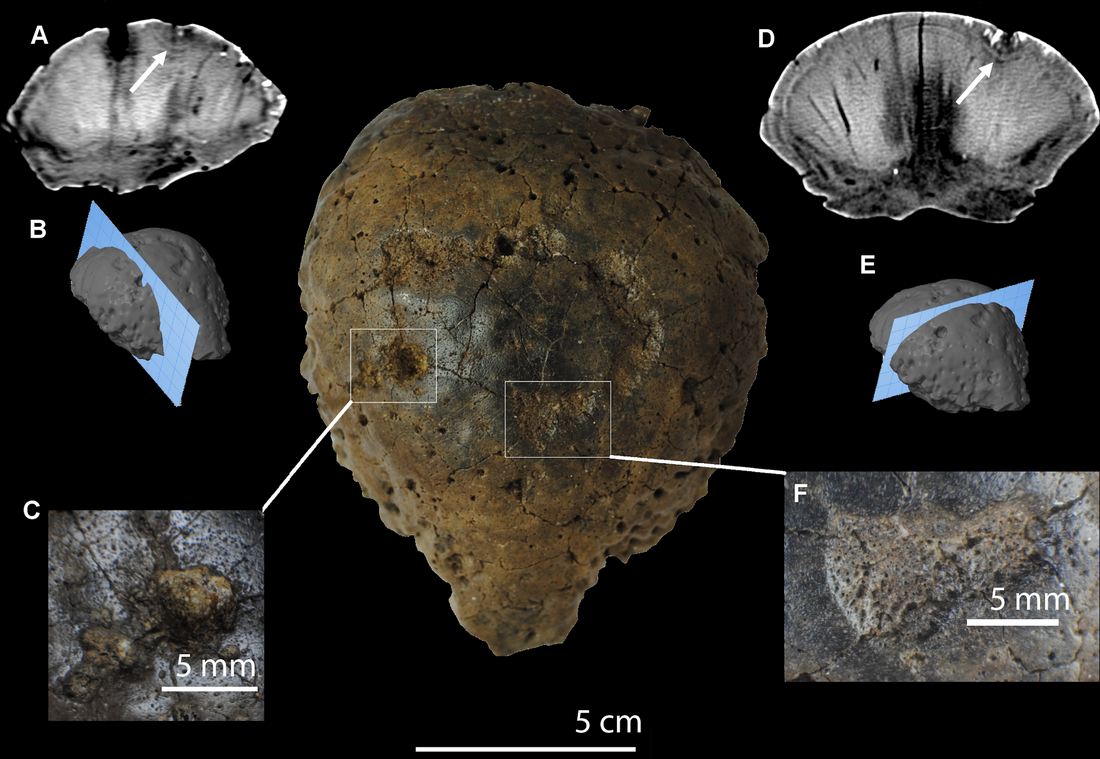 Hanssuesia