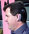 Ken Bolingbrokes cochlear implant.jpg
