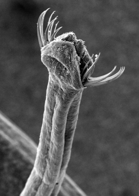 Detail of the head region of an arrow worm