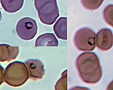 Ring forms of Plasmodium falciparum in red blood cells