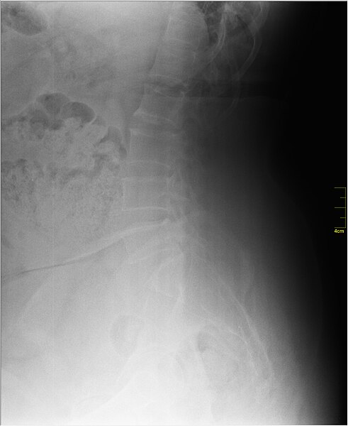 File:Medical X-Ray imaging QUT06 nevit.jpg