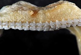 Upper teeth