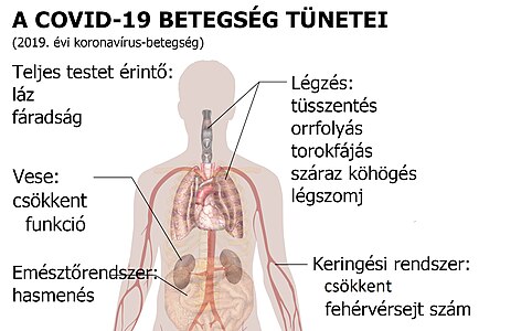 A zoonózisok közé tartozó COVID-19 megbetegedés tünetei