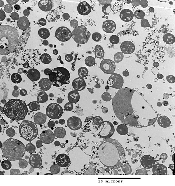 Transmission electron micrograph of a population of L-form Bacillus subtilis, showing a range of sizes. Scale bar is 10 micrometers.