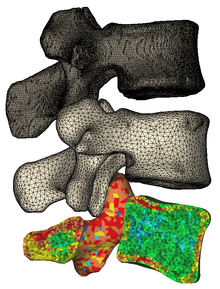 Spinal vertebrae displaying various mesh options. Top: normal high-density STL; Middle: surface mesh for FEA; Bottom: volume mesh including grayvalue-based material assignment 3d vertebrae surface meshes.png