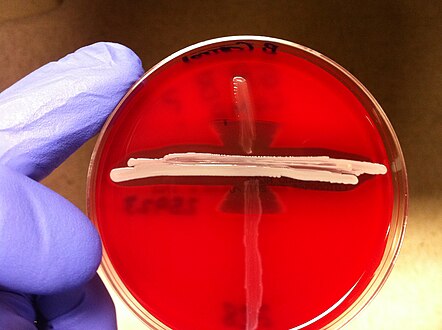 This is an example of a positive CAMP test indicated by the formation of an arrowhead where the Strep group B (Streptococcus agalactiae) meets the Staphylococcus aureus (light-yellow/golden middle streak).