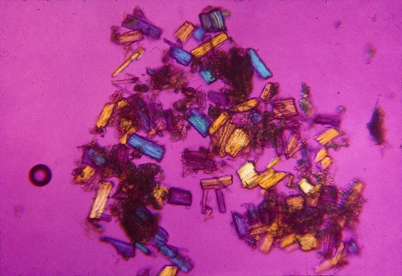 File:CSIRO ScienceImage 1600 Protein Crystals.jpg