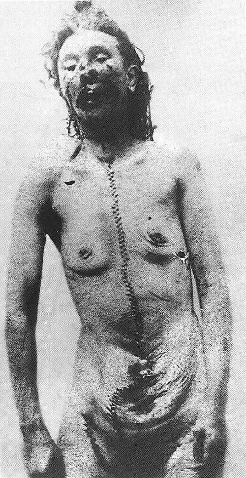Mortuary photograph of Eddowes after her post-mortem