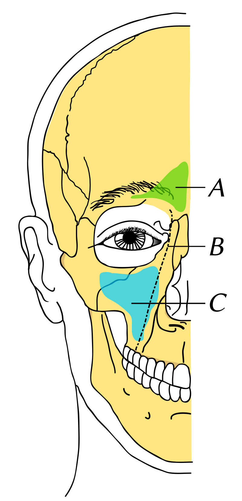 Sinus frontal — Wikipédia