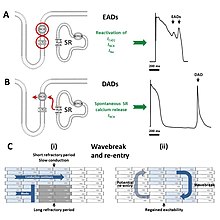 Cellular mechanisms of early afterdepolarizations (EADs) and delayed afterdepolarizations (DADs). Mechanisms of arrhythmia.jpg