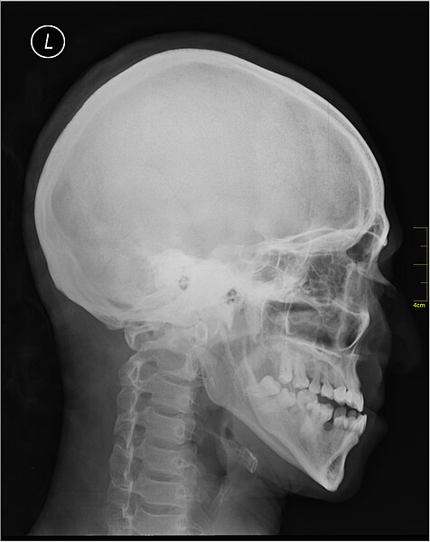 File:Medical X-Ray imaging NJX06 nevit.jpg