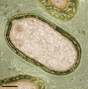 Description de l'image Pandoravirus salinus 298x300.png.