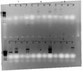 Miniatura para Amplificación aleatoria de ADN polimórfico