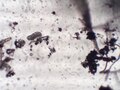 File:Tardigrado al microscopio, 100X.webm
