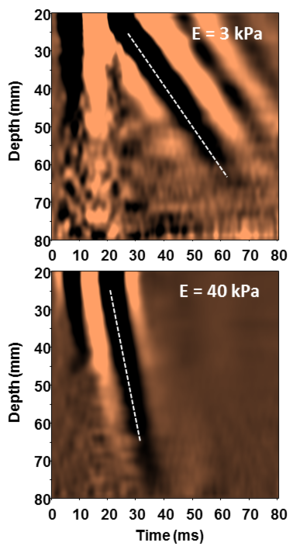 Elastography