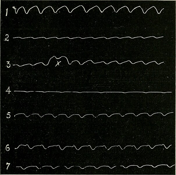 File:American journal of physiology (1898) (14802182453).jpg