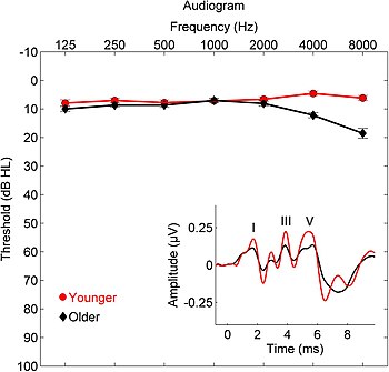 Average hearing thresholds in decibels (SPL) (the unit of 'dB(HL)' shown on the vertical axis is incorrect) are plotted from 125 to 8000 Hz for younger (18-30 year olds, red circles) and older adults (60-67 year olds, black diamonds). The hearing of older adults is shown to be significantly less sensitive than that of younger adults at frequencies of 4000 and 8000 Hz, corresponding approximately to the piano keys and tones of b'''' (B7) and b''''' (B8), respectively. B8 is near the high end of the piano frequency range. Average click-evoked waveforms and Average hearing thresholds for younger and older adults.jpg